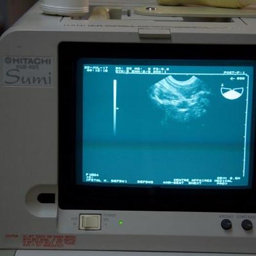 Used HITACHI EUB 405 PORTABLE ULTRASOUND SCANNER WITH 2 PROBES