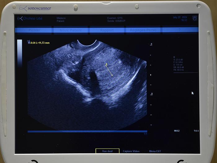 original-d-occasion-echographe-sonoscanner-orcheo-lite.JPG