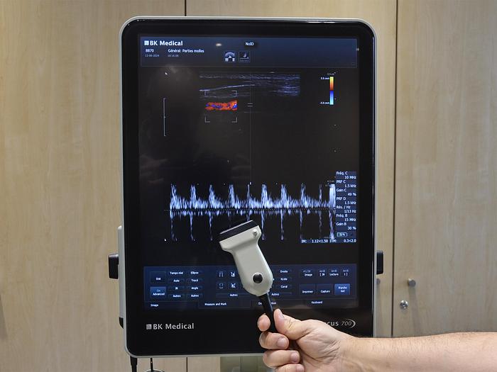 original-d-occasion-echographe-bk-focus-700-a-ecran-tactile-avec-5-sondes.JPG