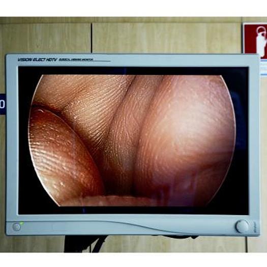 Used COELIO STRYKER 1288HD HIGH DEFINITION COLUMN