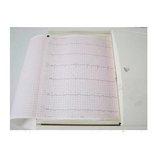 Used E.C.G SECA CT6I 12 TRACKS REST & EFFORT