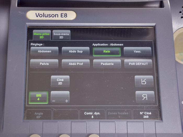 Used VOLUSON E8 GENERAL ELECTRIC ULTRASOUND