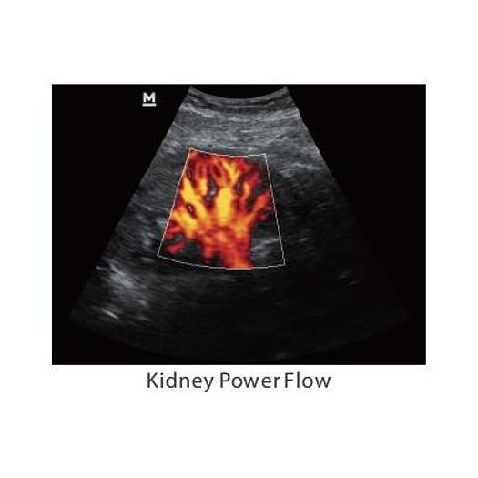 MINDRAY Z5 COLOR DOPPLER SYSTEM