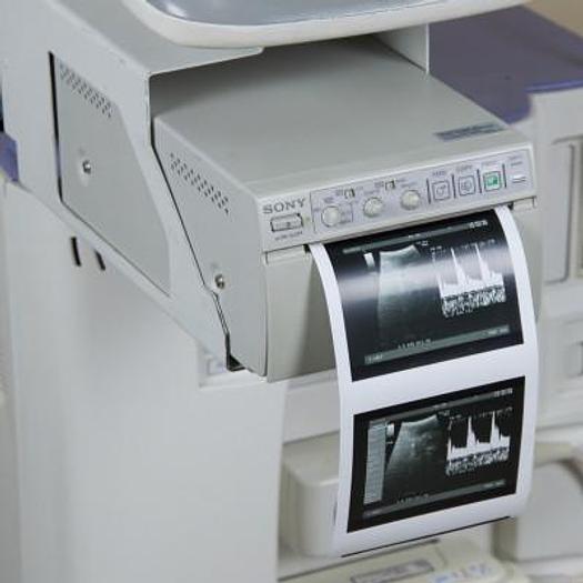 Used ALOKA SSD-3500 PROSOUND ULTRASOUND SCANNER, FLAT SCREEN AND 3 PROBES