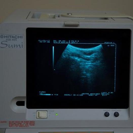 Used HITACHI EUB 405 PORTABLE ULTRASOUND SCANNER WITH 2 PROBES