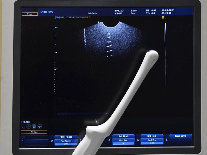 Used PHILIPS HD9 3D/4D ULTRASOUND with 4 PROBES