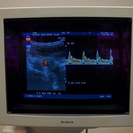 Used ALOKA PROSOUND 3500 PLUS COLOR DOPPLER ULTRASOUND WITH 2 PROBES