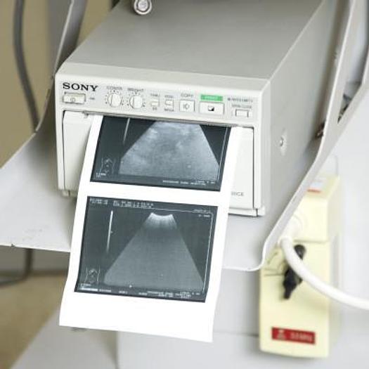 Used HITACHI EUB 405 SUMI PORTABLE ULTRASOUND WITH 2 PROBES