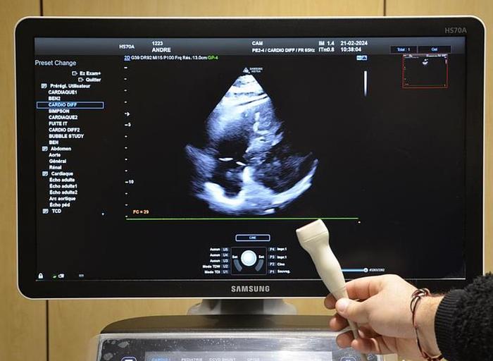 D'occasion ECHOGRAPHE CARDIAQUE  SAMSUNG HS 70 