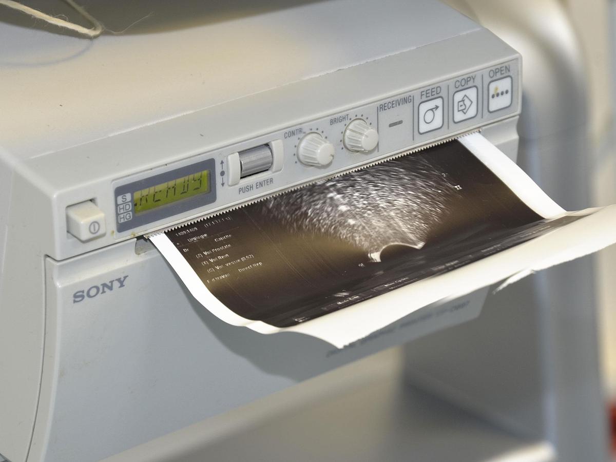 D'occasion GE LOGIQ P6 ULTRASOUND with 2 probes