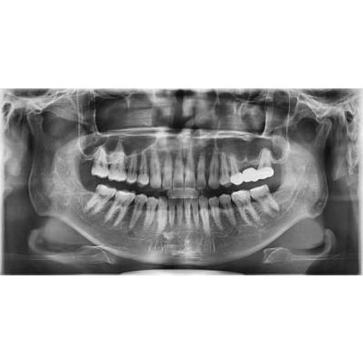 Used VATECH PAX I 3D SMART DENTAL PANORAMIC with CEPHALOSTAT (Panorama + Cephalo Scan Shot + CBCT)