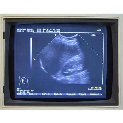 Used HITACHI EUB 525 COLOR DOPPLER ULTRASOUND SCANNER WITH 3 PROBES