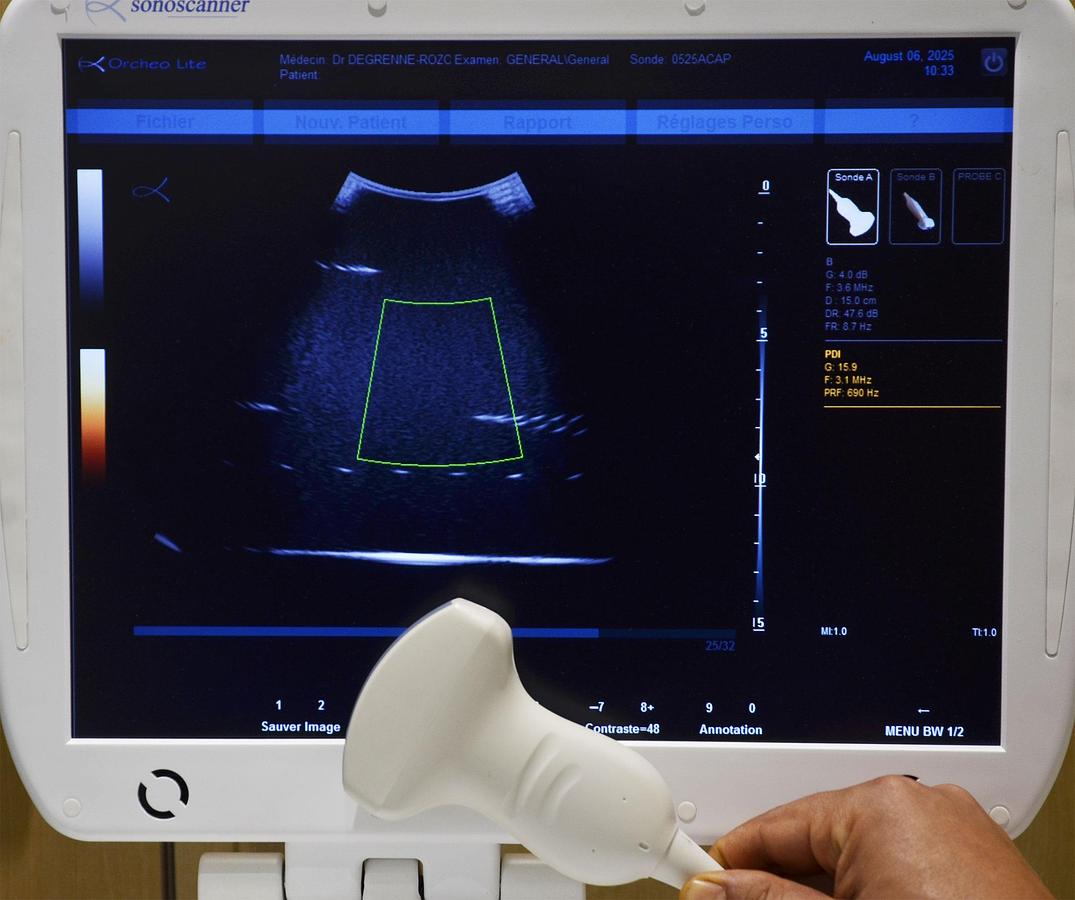 D'occasion SONOSCANNER ORCHEO LITE PORTABLE ULTRASOUND