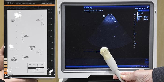 D'occasion ECHOGRAPHE MINDRAY DP-50