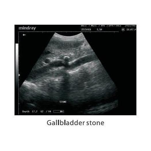 MINDRAY DP-10 ULTRASOUND SCANNER WITH LED MONITOR AND 1 CONVEX PROBE