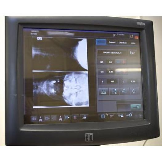 Used FUJIFILM SCANNING SYSTEM