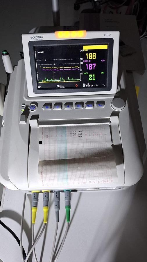 Rénové TOCOCARDIOGRAPHE CTG  PHILIPS GOLDWAY (gemellaire) FHR FETAL MONITOR TWINS