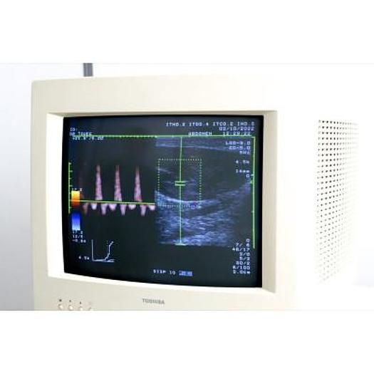 Used TOSHIBA POWERVISION 6000 ECHOCARDIOGRAPH WITH 3 PROBES