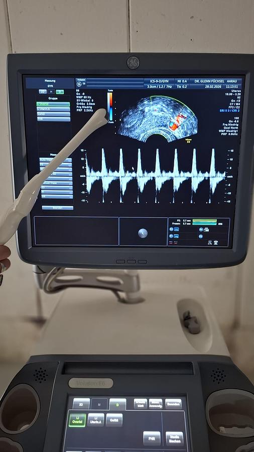 D'occasion ULTRASOUND GENERAL ELECTRIC GE VOLUSON E6