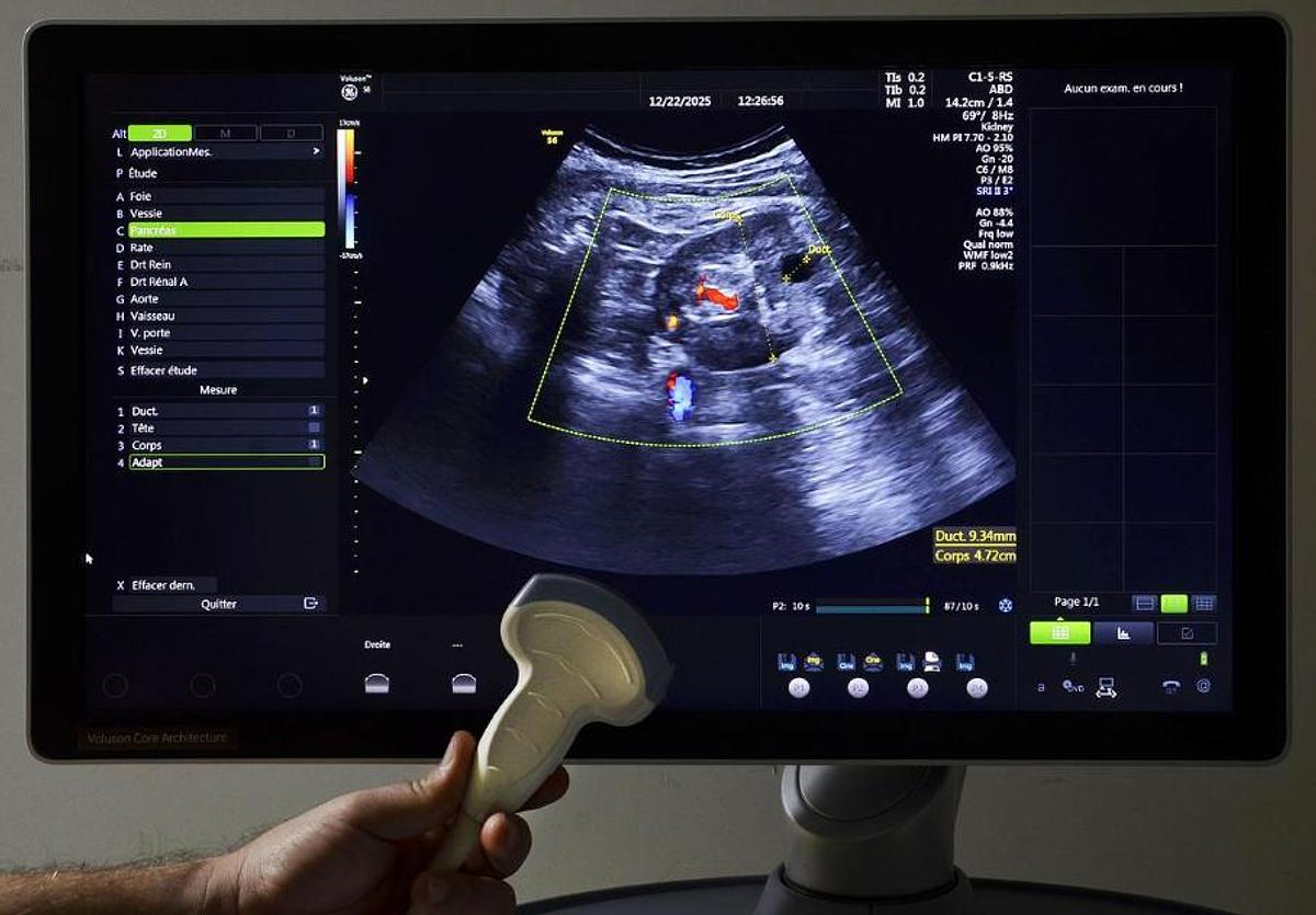 D'occasion GENEAL ELECTRIC VOLUSON S6 ULTRASOUND UNIT