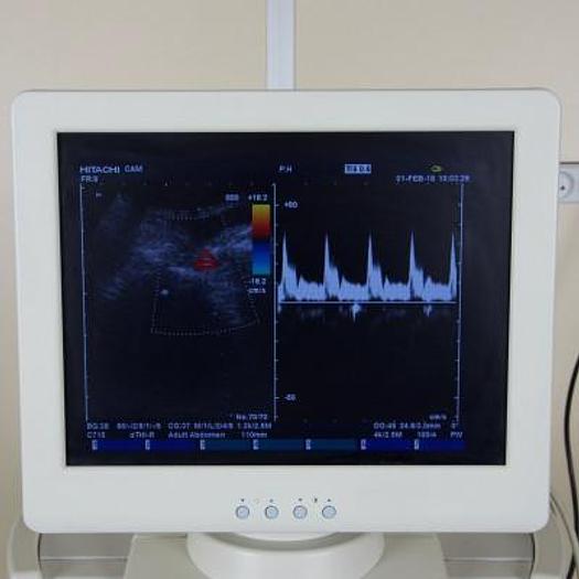 Used HITACHI EUB-5500 COLOR ULTRASOUND SCANNER WITH FLAT SCREEN AND THREE PROBES