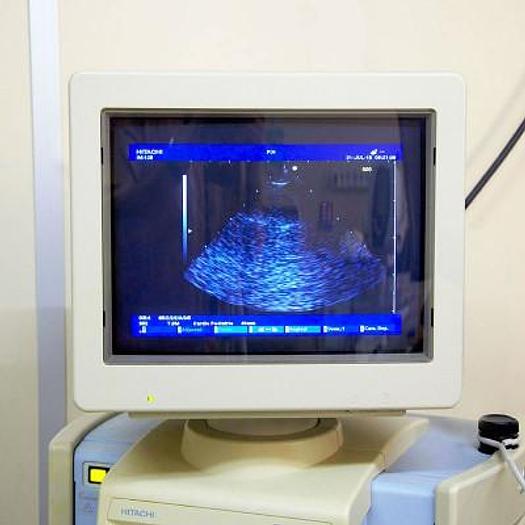 Used HITACHI EUB-6500 PEDIATRIC ECHOCARDIOGRAPH