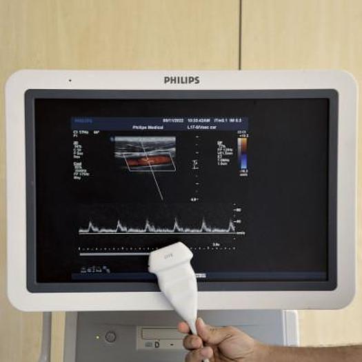 Used PHILIPS IU22 RADIO + CARDIO + GYNECO ECHOCARDIOGRAPH