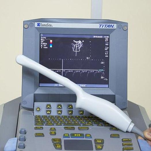 Used SONOSITE PORTABLE ULTRASOUND