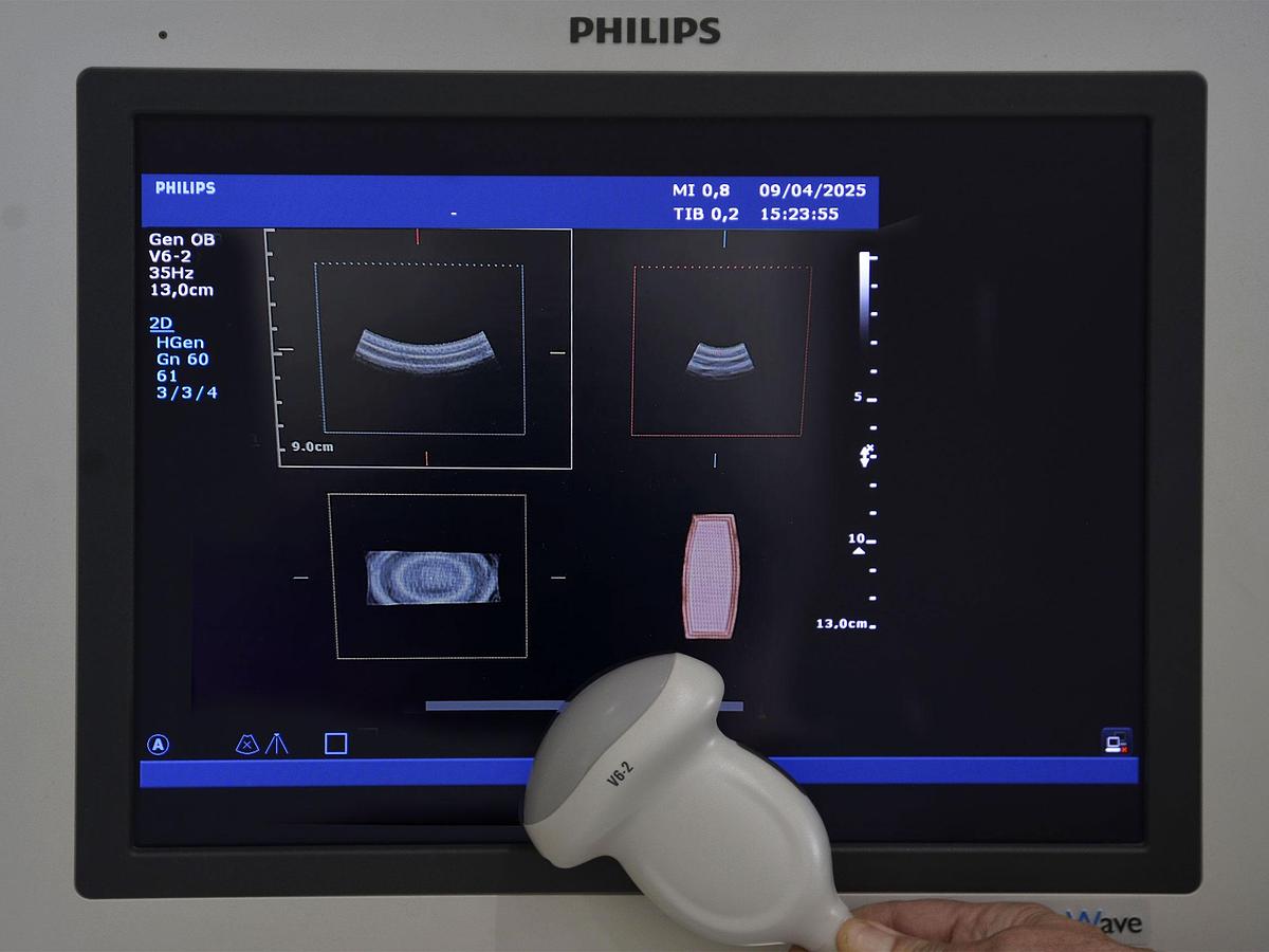 original-d-occasion-echographe-philips-hd-15-2-d-3-d-4-d-gyneco-et-radio.jpg