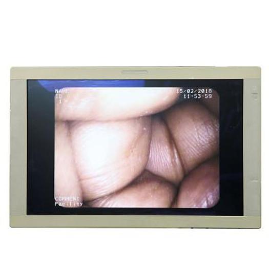 Used VIDEO CYSTOSCOPE PENTAX ECY-1570K 2.0