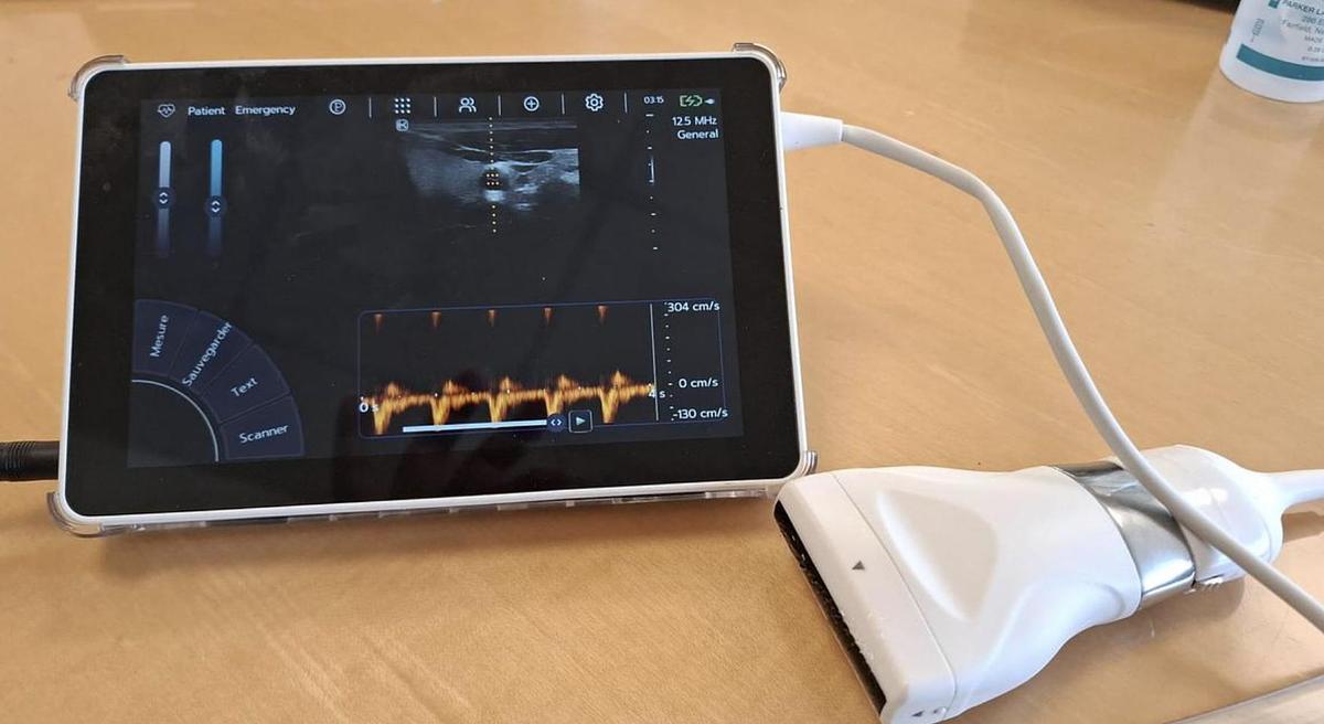 D'occasion ULTRA LITE SONOSCANNER AVEC SONDE LINEAIRE