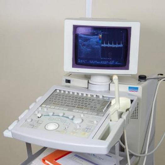 Used HITACHI ODYSSEE DOPPLER ULTRASOUND WITH 2 PROBES