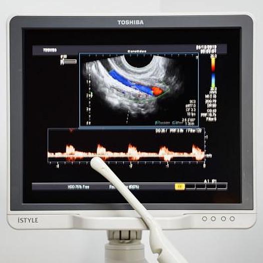Used TOSHIBA APLIO MX ULTRASOUND SCANNER