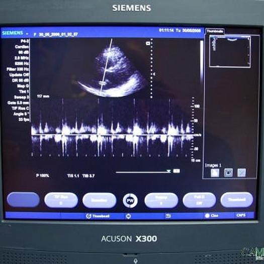 Used VETERINARY ULTRASOUND SIEMENS ACUSON X300 WITH 2 PROBES AND FLAT SCREEN