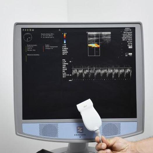 Used MINDRAY ZONARE ECHOCARDIOGRAPH