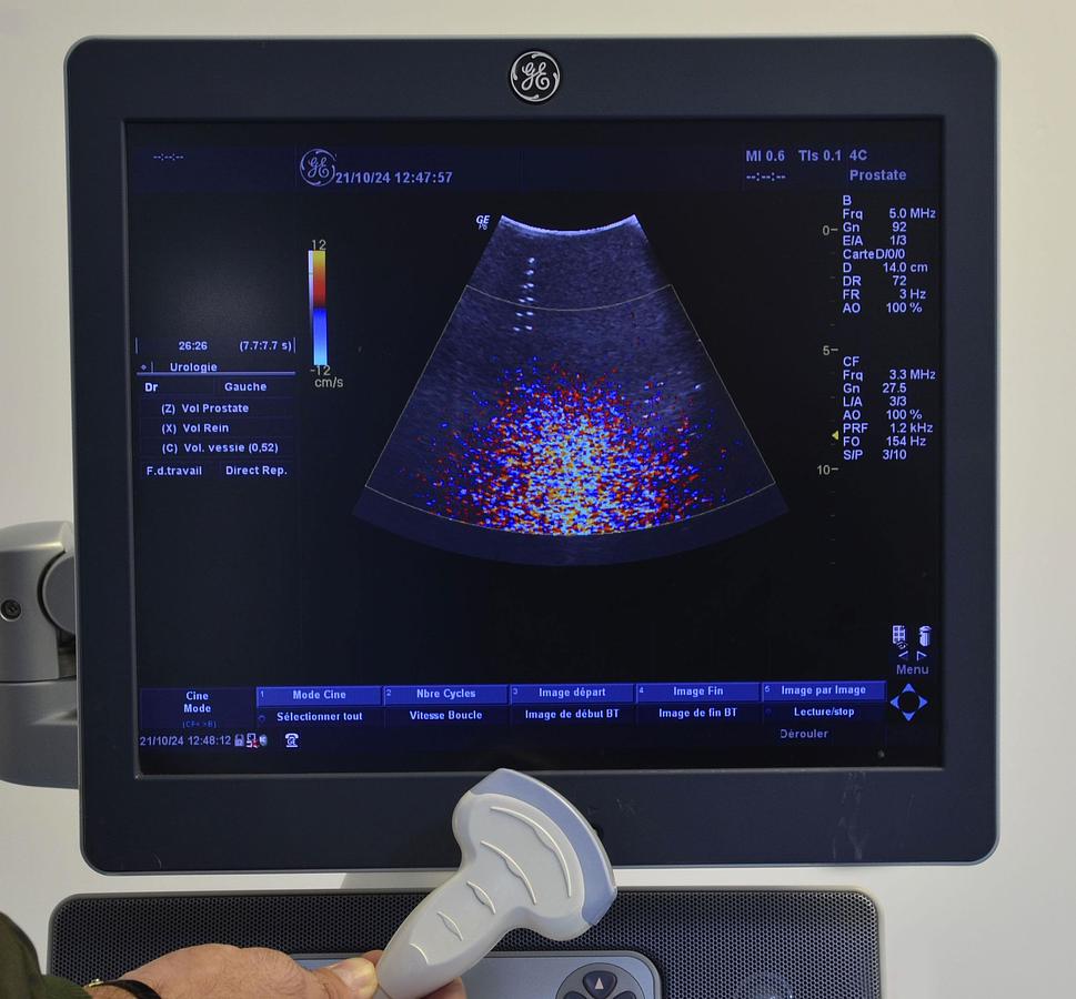 D'occasion GE LOGIQ P6 ULTRASOUND with 2 probes