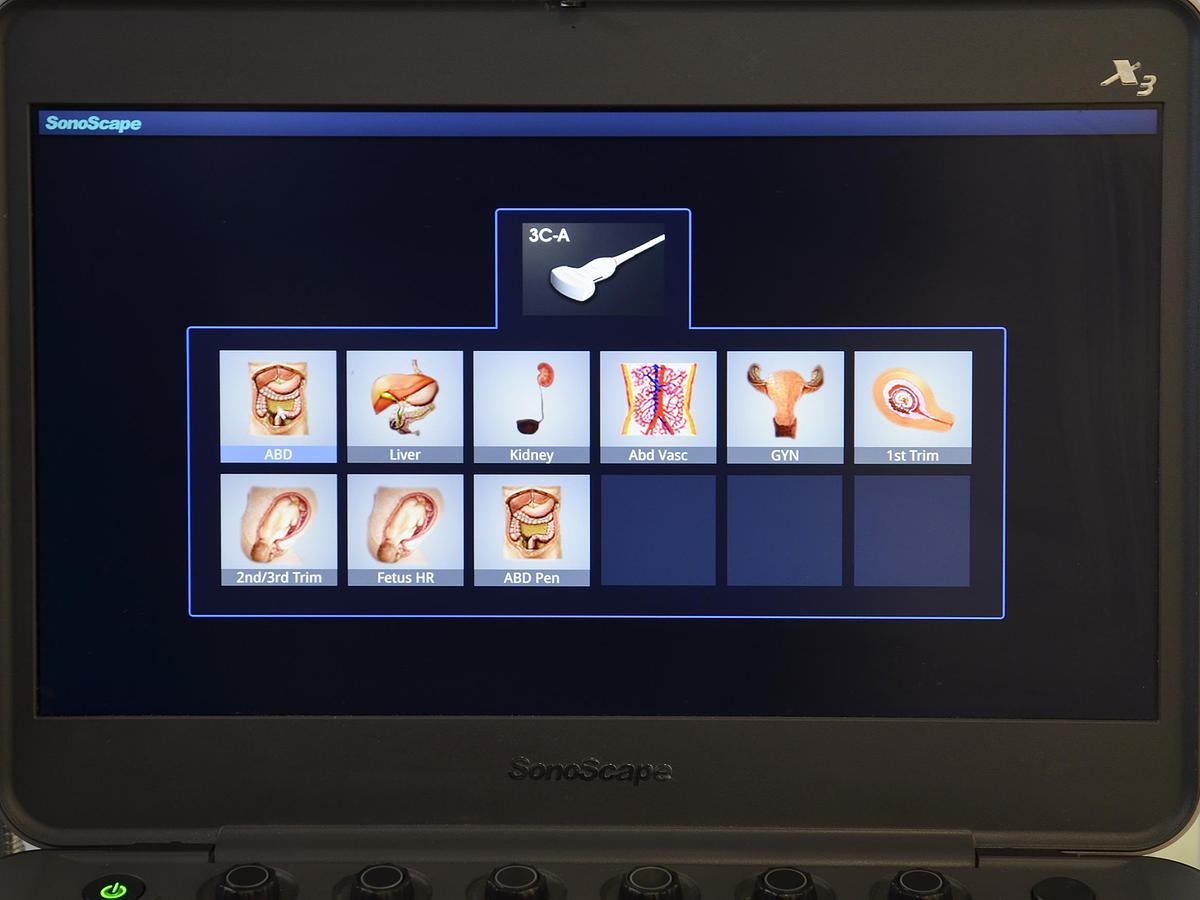 original-d-occasion-echographe-portable-sonoscape-x3-avec-2-sondes-convexe-et-endocavitaire.JPG