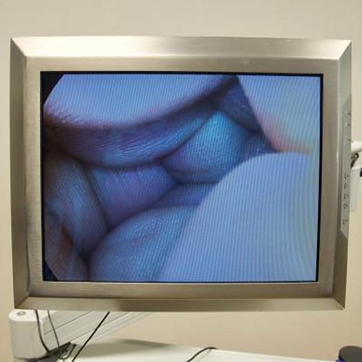 Used INTERVENTIONAL ENDOSCOPY COLUMN WITH GIMMI FLAT SCREEN