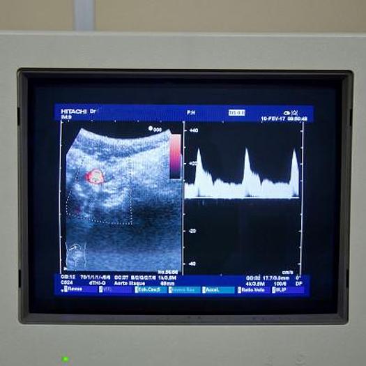 Used HITACHI PLATFORM ELITE COLOR DOPPLER ULTRASOUND WITH 3 PROBES