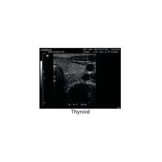 MINDRAY DP-20 ULTRASOUND SCANNER WITH LED MONITOR AND 1 CONVEX PROBE