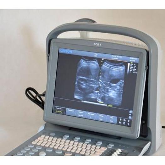 CHISON ECO1 PORTABLE ULTRASOUND WITH ABDOMINAL PROBE