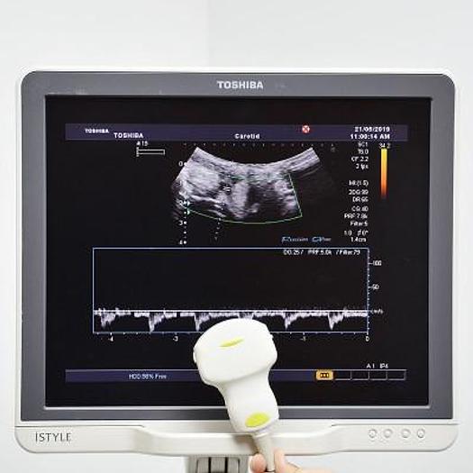 TOSHIBA APLIO ULTRASOUND SCANNER (SSA-780A) COLOR DOPPLER FLAT SCREEN