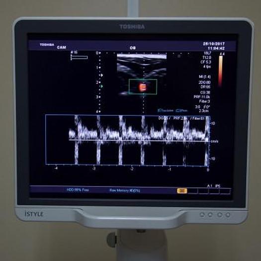 Used TOSHIBA APLIO MX COLOR DOPPLER ULTRASOUND SCANNER