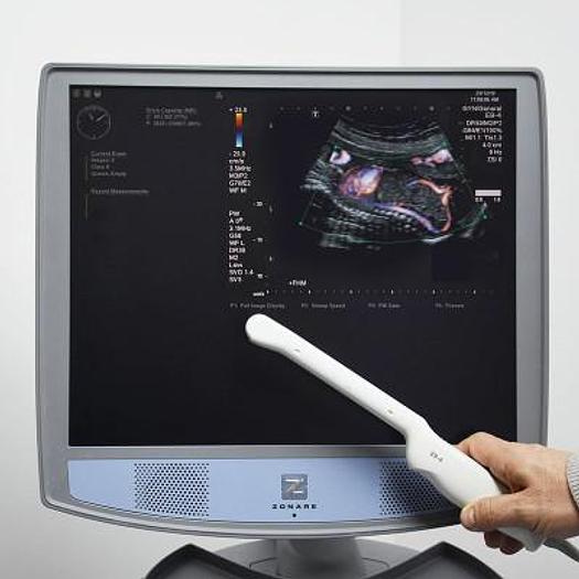 Used ZONARE Z.ONE SCAN SYSTEM VERSION 4.7.323F