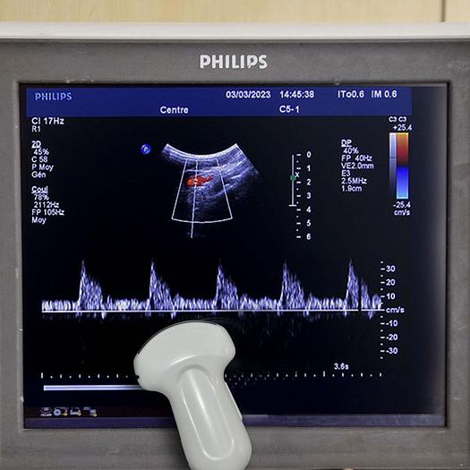 Used ECHOCARDIOGRAPHE PHILIPS IE33 RADIO CARDIO GYNECO