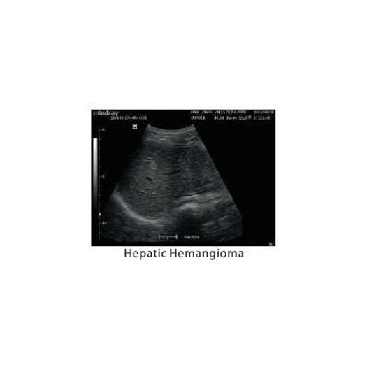 MINDRAY DP-20 ULTRASOUND SCANNER WITH LED MONITOR AND 1 CONVEX PROBE
