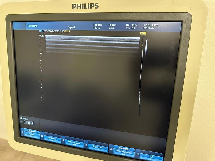 Used PHILIPS HD9 3D/4D ULTRASOUND with 4 PROBES