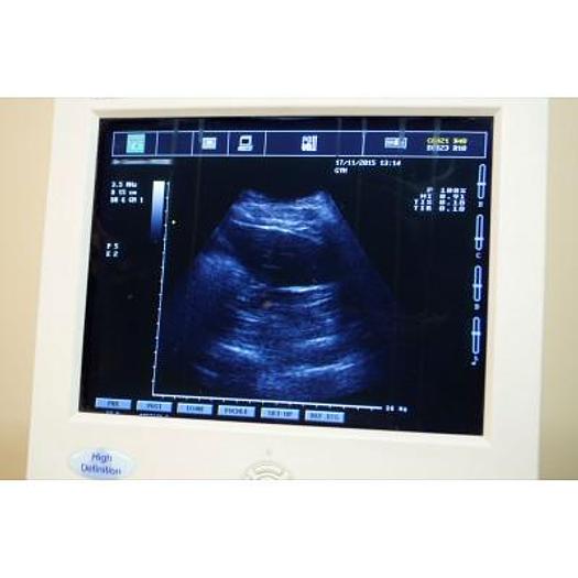 Used ESAOTE PICUS PRO ULTRASOUND SCANNER WITH 1 PROBE