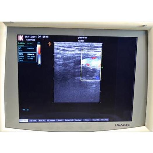Used ECHOCARDIOGRAPHY KONTRON IMAGIC 5000 COLOR DOPPLER with 4 probes