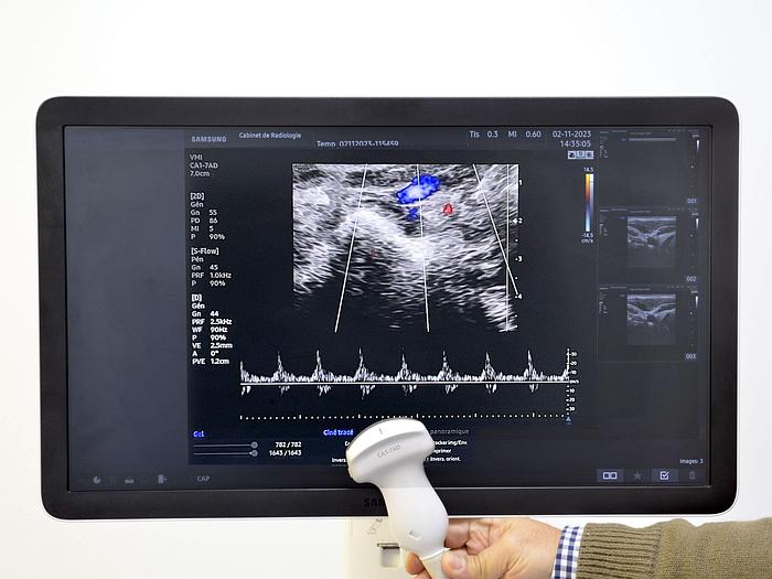Used SAMSUNG HS 50 ULTRASOUND SCANNER